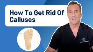 How Do You Get Rid Of Calluses Permanently [upl. by Edmund]