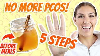 How to Reverse PCOS Naturally 5 Easy Diet  Exercise HACKS [upl. by Woodsum313]