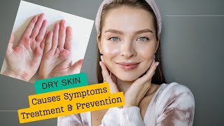 Dry Skin Types Risk Factors and Treatments [upl. by Scever]