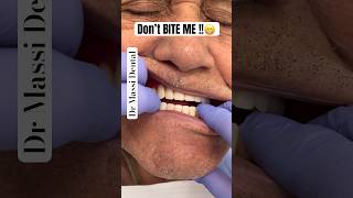 DON’T BITE ME 🤣😁 Don’t bite your DENTIST [upl. by Blood]