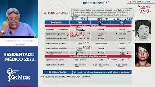 Endocrinología  2 TIROIDES [upl. by Leiba73]