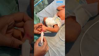 Wound Repair medical newbornbaby viralvideo [upl. by Ainival711]