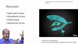 Exploring the Third Ventricle in Neuroanatomy  Brain Structures Simplified [upl. by Lennaj]