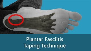 Plantar Fasciitis Taping Technique [upl. by Carlos320]