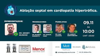 Ablação Septal em Cardiopatia Hipertrófica [upl. by Cressida]