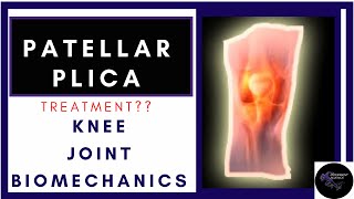 patellar plica syndrome treatment biomechanics explained physiotherapy tutorials [upl. by Erlina]