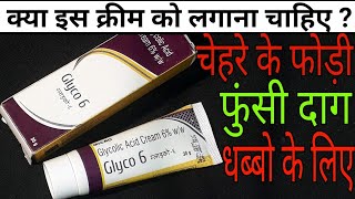 Glyco 6 Cream Review Hindi [upl. by Kessiah254]