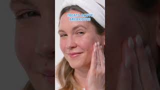 Which product should you use to treat your acne Learn more about effaclar adapalene and serum​ [upl. by Orlantha]