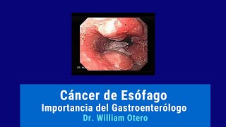 Cáncer de Esófago Importancia del Gastroenterólogo Dr WIlliam Otero [upl. by Beaufort]