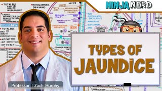 Gastrointestinal  Types of Jaundice [upl. by Malaspina]