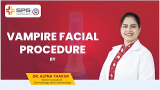 Vampire FacialMicroneedling Procedure by Dr Alpana Thakur  SPS Hospitals [upl. by Ait238]