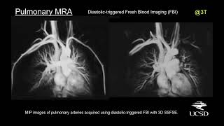 Multimodality Vascular Imaging From Head to Toe  Course Sample [upl. by Morgana]