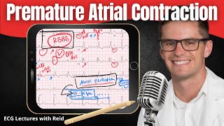 Premature Atrial Contractions PAC EKG  ECG Lecture [upl. by Ennairac]