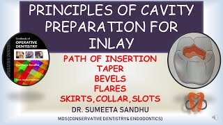 Principles of Inlay cavity preparation inlay cavity preparation bevels in inlay [upl. by Akilak956]