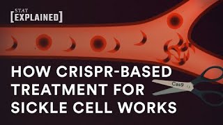 New CRISPRbased sickle cell treatment explained [upl. by Fawnia]