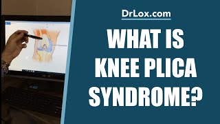 What is Knee Plica Syndrome  Do You Need Plica Surgery  Dr Lox Explains [upl. by Staw]