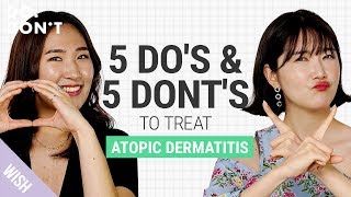 How to Treat Atopic Dermatitis  For Those Who Want A Life Change  DoampDont [upl. by Irret648]