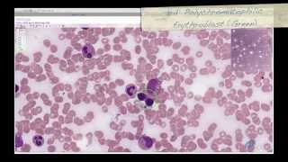 Histology Helper  Blood Histology [upl. by Adnauqahs]