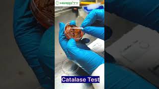 Catalase Test microbiology [upl. by Neeoma903]