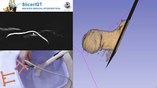 Realtime 3D ultrasound reconstruction using 3D Slicer  SlicerIGT [upl. by Nrublim]