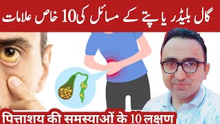 The 12 Signs that Your Gallbladder is in Danger  Dr Javaid [upl. by Dorkas]