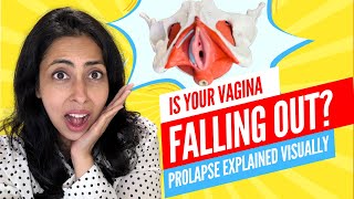 Pelvic Organ Prolapse Why It Happens with Dr Nabila Noor [upl. by Diley]