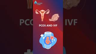 Is IVF Possible In PCOS  Dr Supriya Puranik ivfinpcos mothercare drsupriyapuranik ivf iui [upl. by Analos485]