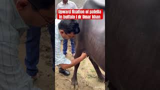 Upward fixation of patella l dr Umar khan [upl. by Yusem116]