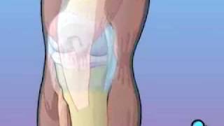 PreOp® Anterior Cruciate Ligament Patient Education [upl. by Morrill]