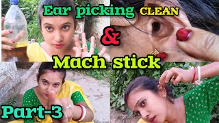 EAR PICKING CLEAN CHALLENGEEAR PICKING CLEAN MUSTARD OIL WITH MACH STICKPART3requestvideoCHALLE [upl. by Madalena]