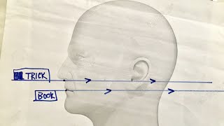 How To Take An Odontoid View XRay  Perfectly  Every Time [upl. by Mutz]