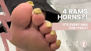 4 Rams horn nails on one foot 🐏 [upl. by Ahsotal]