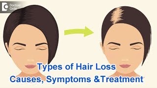 Types of Hair Loss  Common Causes Symptoms amp Treatment  Dr Kavitha GV Mandal [upl. by Nwahsat]