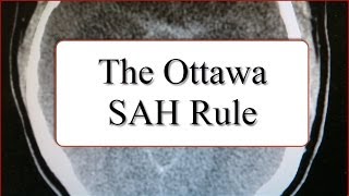 The Ottawa SAH Rule [upl. by Flessel147]