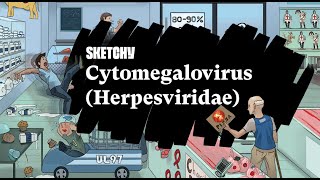 Understanding CytomegalovirusHerpes Virus Family Study Full Lesson Sketchy Medical USMLE Step 1 [upl. by Nysila]