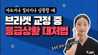 부산교정치과 브라켓 교정 중 응급상황 대처법통증와이어찔림브라켓 떨어짐고무줄변색 [upl. by Skiba933]