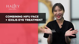 Combining HIFU Face Lifting amp Exilis Ultra 360 Eye Treatments [upl. by Nester]