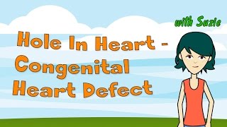 Hole In Heart  Congenital Heart Defect [upl. by Araec]