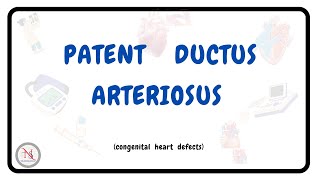 PATENT DUCTUS ARTERIOSUS  Causes  Symptoms  Pathophysiology  Treatment  The Nurses Station [upl. by Asseralc]