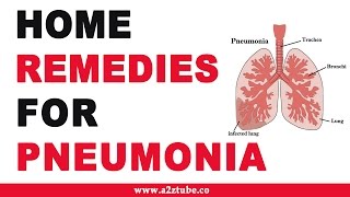 Pneumonia – Natural Ayurvedic Home Remedies [upl. by Balliett]