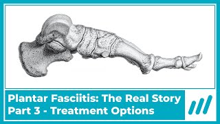 Plantar Fasciitis Part 3 Treatment Options [upl. by Speroni]