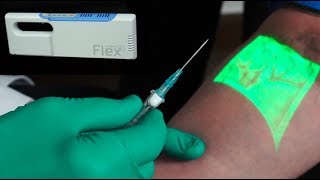 Vein Finder for Patient Comfort  Finding Veins is Easy 🔎 [upl. by Kubetz805]