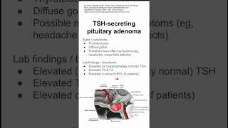 TSHsecreting pituitary adenoma [upl. by Obeng]