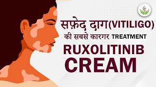 Ruxolitinib Cream  Latest Treatment For Vitiligo 2023  Care Well Medical Centre [upl. by Itsirhc]