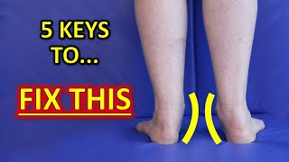 The 5 KEYS To Improve Flat Feet Fallen Arches amp Foot Overpronation [upl. by Golightly]