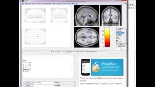 xjView secrete Creating a mask based on anatomy [upl. by Ninnette676]