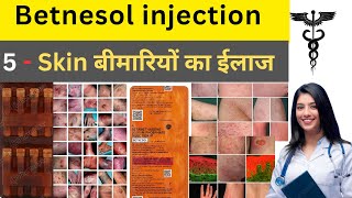 Betnesole Injection  Betnosole Injection Use in hindi  Medicine knowledge  Allergy  Treatment [upl. by Rickie]