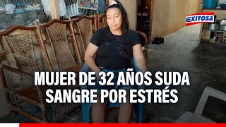 🔴🔵Mujer de 32 años pide ayuda a especialistas por extraña enfermedad que le hace sudar sangre [upl. by Snider]