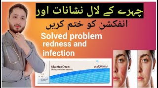 How to solved problem face redness skin Infection problem solved advantan cream [upl. by Binky]