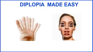 DIPLOPIA MADE EASY [upl. by Evyn455]